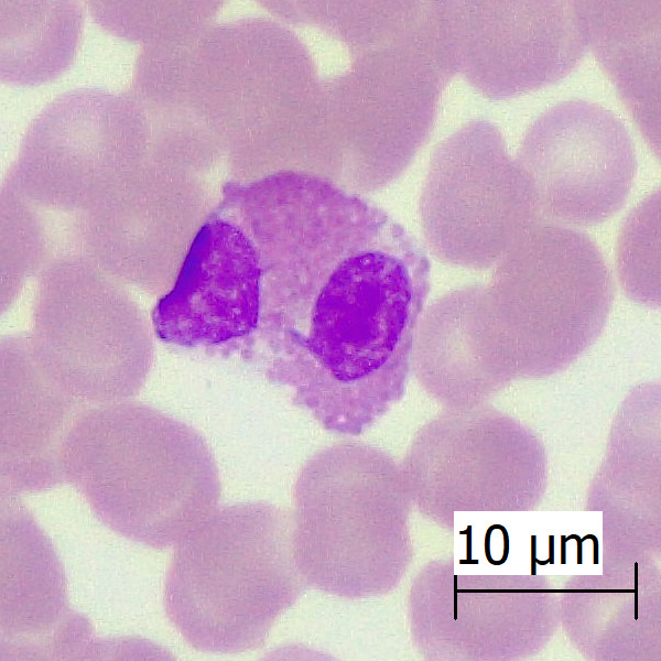 eosinófilo