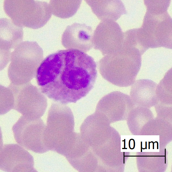 eosinófilo