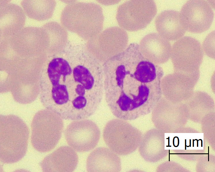 neutrófilo